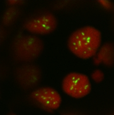Punctate loci obtained by expression and chloroplast targeting of multiple carboxysomal proteins (Red=chlorophyll autofluorescence; Green=YFP label on a carboxysomal protein)
